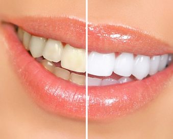 Cosmetic Dentistry